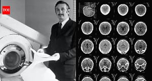 In 1971, engineer Godfrey Hounsfield’s new scanner revealed a brain cyst in the first clinical CT scan; 8 years later, he shared the Nobel Prize for developing computer-assisted tomography