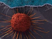 Delhi-NCR's toxic air may have role in gynaecological cancers, say experts