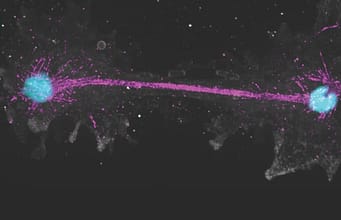 ‘Fire amoeba’: Scientists discover single-celled organism that reproduces at 145°F, setting heat-tolerance record for complex life |